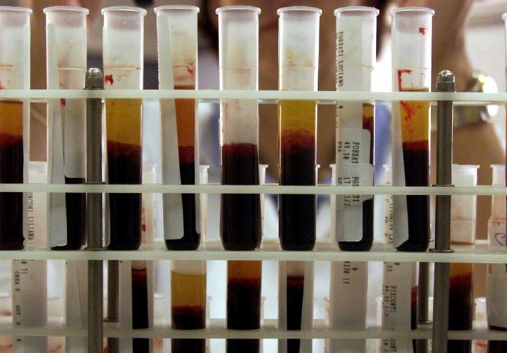 trasfusioni infette