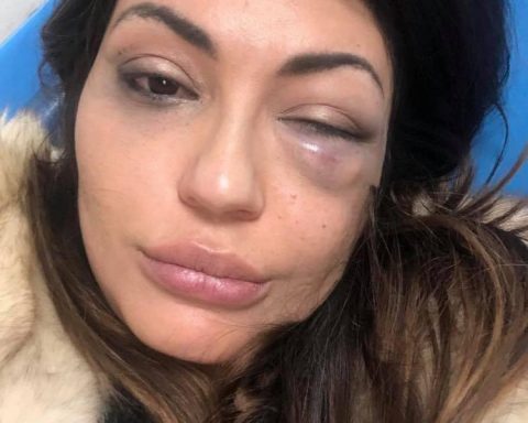 Vanesa Rodriguez, dopo l'aggressione subita il 21 gennaio 2019 al ristorante "Veneziano" a Formia