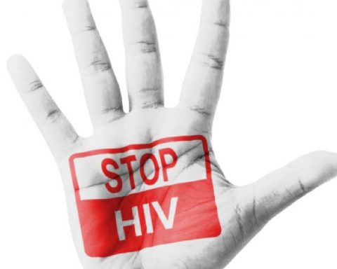 hiv-aids