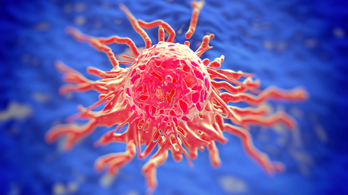 sarcoma dei tessuti molli