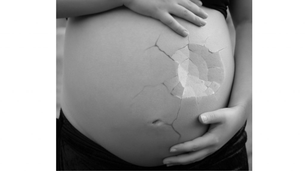 aborti spontanei