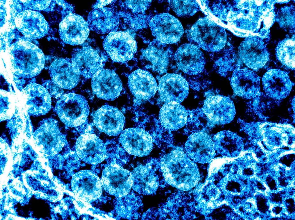 Coronavirus