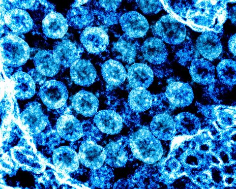Coronavirus