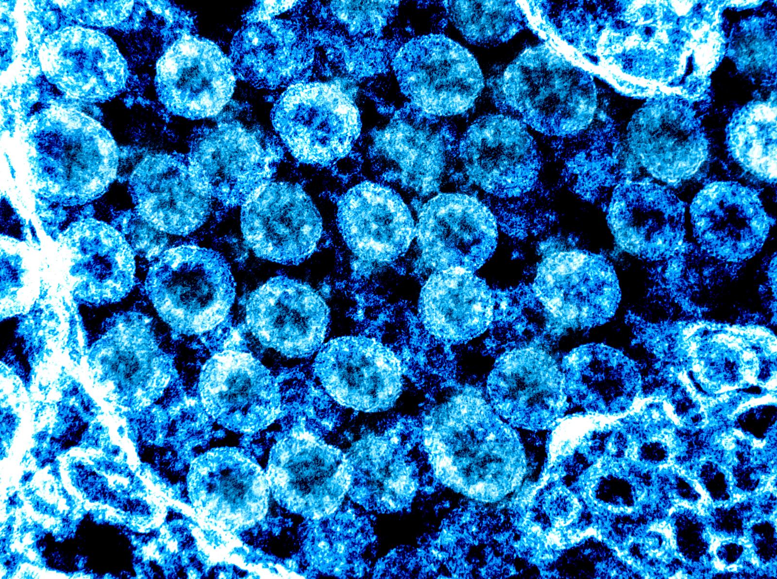 Coronavirus