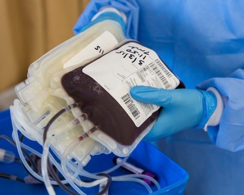 terapia al plasma