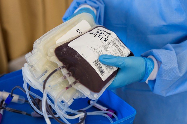 terapia al plasma