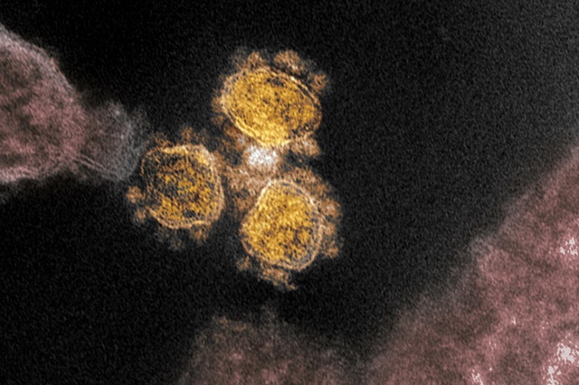 virus