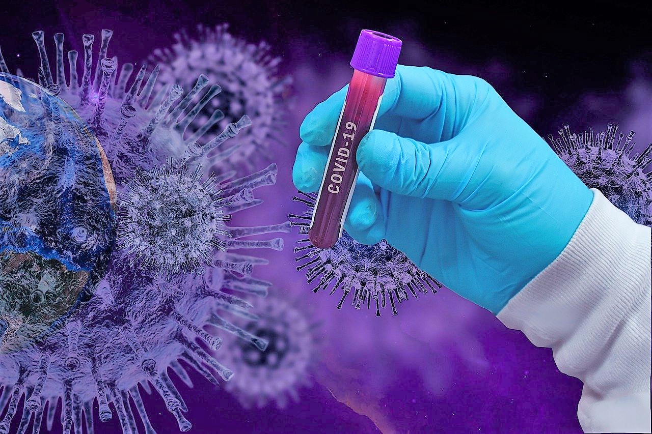Covid-19-Coronavirus