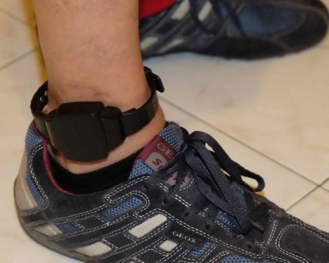 braccialetto elettronico